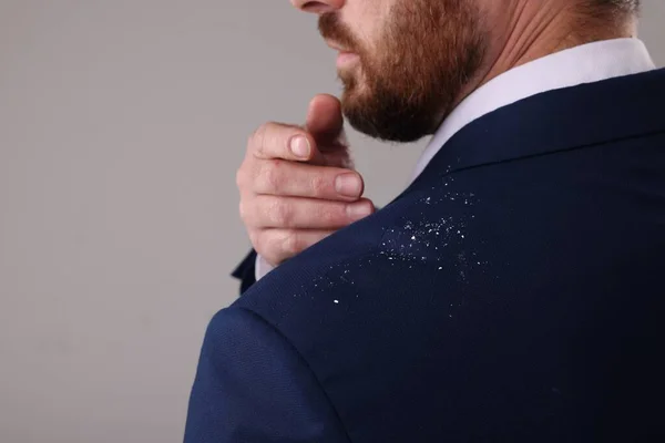 Man Swiping Dandruff His Suit Grey Background Closeup Space Text — Stock Photo, Image