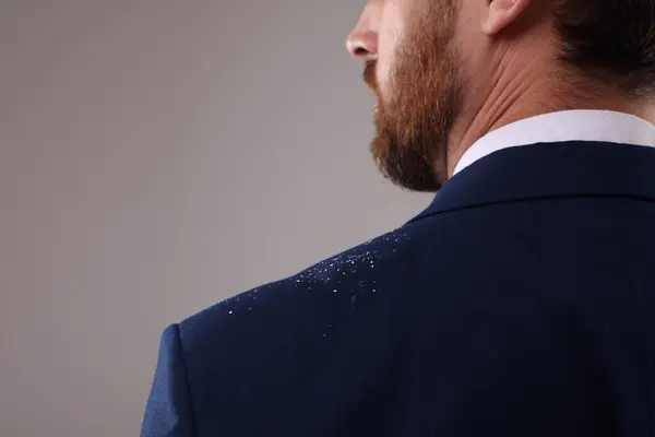 Man Dandruff His Suit Grey Background Closeup Space Text — Stock Photo, Image