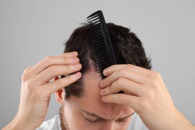 Kepek problemi. Taraklı bir adam açık gri arka planda saçını ve kafa derisini inceliyor. Yakın plan.