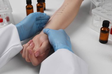 Doktor ışık masasında cilt alerjisi testi yapıyor, yakın plan.