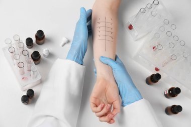 Doktor ışık masasında cilt alerjisi testi yapıyor.
