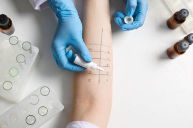 Doktor ışık masasında cilt alerjisi testi yapıyor.