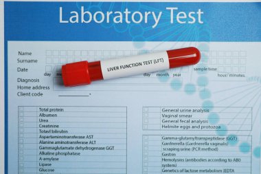 Karaciğer Fonksiyon Testi. Laboratuvar formunda kan örneği olan tüp, üst görünüm.