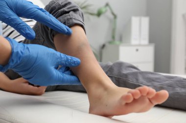 Doktor, çocuğun bacağını hastanede çürükle kontrol ediyor. Yakın plan.