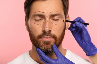 Pembe arka planda estetik ameliyat için kalem hazırlayan bir doktor, yakın plan.