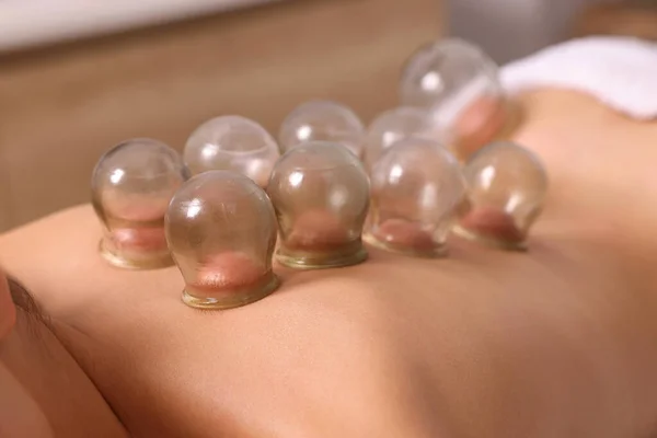Cupping therapy. Closeup view of woman with glass cups on her back indoors
