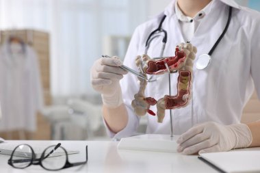 Gastroenterolog klinikteki masada kalın bağırsağın anatomik modelini gösteriyor.