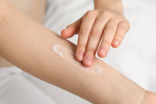 Young woman with dry skin applying cream onto her arm on bed, closeup