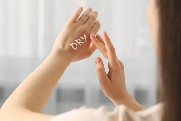 Young woman with word Dry made of cream on her hand indoors, closeup