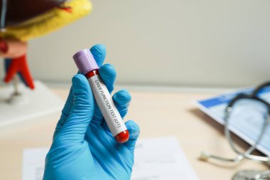 Laboratuvar çalışanı elinde kan örneği ve etiket testi olan tüpü masanın üzerinde tutuyor.