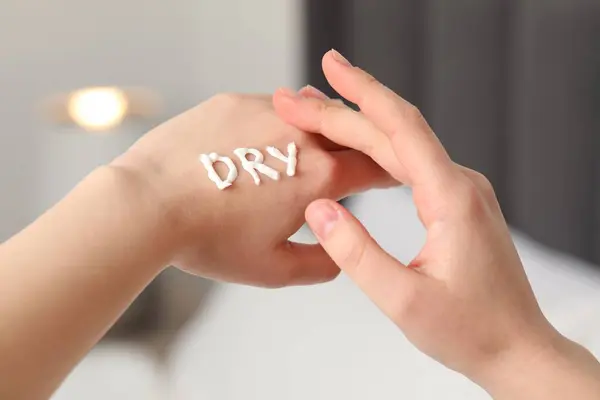 Young woman with word Dry made of cream on her hand indoors, closeup
