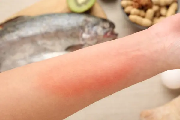 Food allergy. Woman holding hand over products on table, closeup