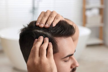 Banyodaki koyu saçlı kepekli adam, yakın plan.