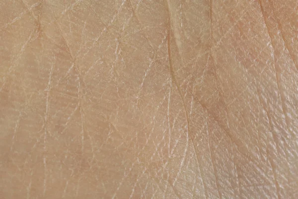 Texture of dry skin as background, macro view