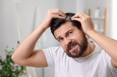 Evde koyu saçlı, kepekli duygusal bir adam.