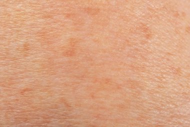 Arkaplan olarak pigmentasyonlu cilt dokusu, makro görünüm