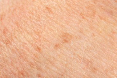 Arkaplan olarak pigmentasyonlu cilt dokusu, makro görünüm
