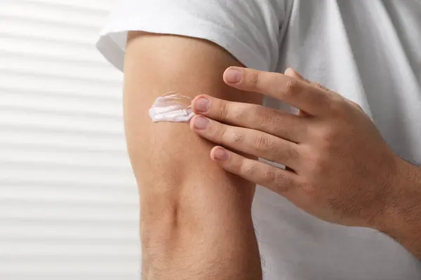 Man with dry skin applying cream onto his arm indoors, closeup