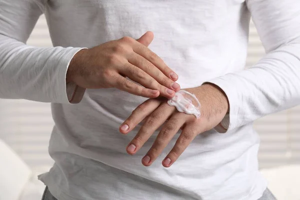 Man with dry skin applying cream onto his hand on light background, closeup
