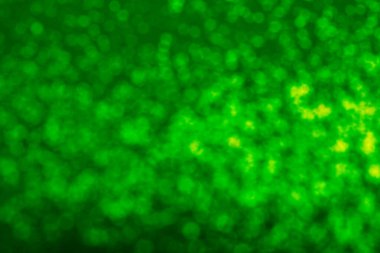 Aziz Patrick günü. Bulanık ışıkları olan yeşil arkaplan, bokeh etkisi