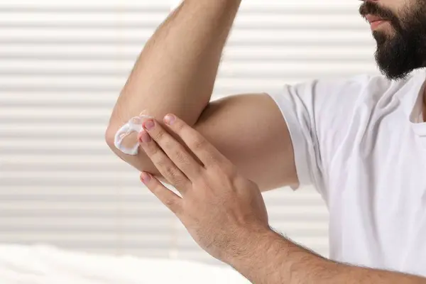 Man with dry skin applying cream onto his elbow on light background, closeup