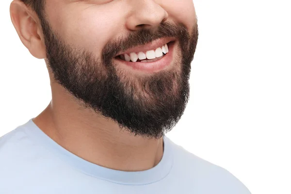 Hombre Con Los Dientes Limpios Sonriendo Sobre Fondo Blanco Primer — Foto de Stock