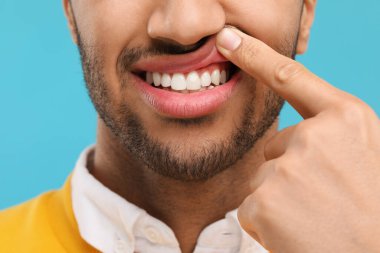 Açık mavi arka planda dişlerini ve dişetlerini gösteren adam, yakın plan.