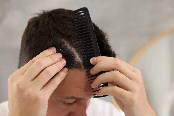 Dandruff problem. Man with comb examining his hair and scalp on light background, closeup