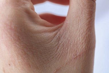 Elinde kuru deri olan kadın açık arkaplanda, yakın plan.