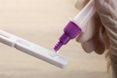 Doktor, bulanık arkaplana karşı kullan at ekspres test kasetine tampon çözeltisi bırakıyor.