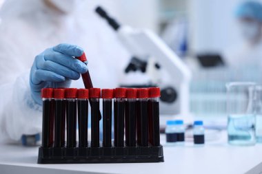 Laboratuvarda test tüplerinde numunelerle çalışan bilim adamı, yakın plan.