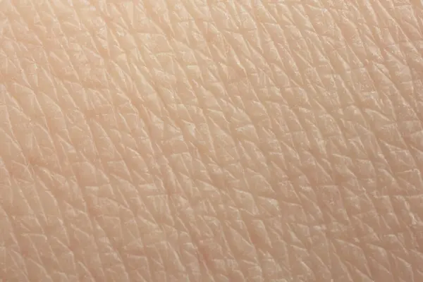 stock image Texture of dry skin as background, macro view