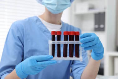 Laboratuvar testi. Hastanedeki tüplerde kan örnekleri olan doktor, yakın plan.