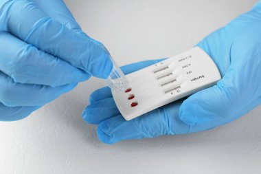 Doktor tek kullanımlık çoklu enfeksiyonlu ekspres test kasetine tampon çözeltisi bırakıyor.