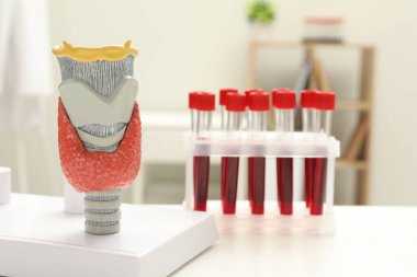 Endokrinoloji. Tiroit bezinin modeli ve klinikteki beyaz masada test tüplerindeki kan örnekleri.