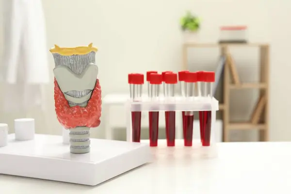 Stock image Endocrinology. Model of thyroid gland and samples of blood in test tubes on white table at clinic