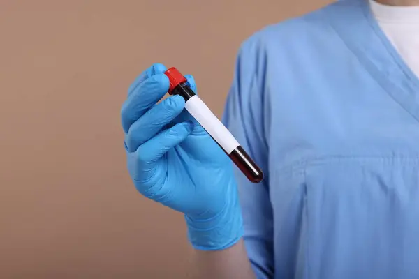 Laboratory testing. Doctor with blood sample in tube on light brown background, closeup. Space for text