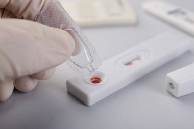 Doktor kullan-at ekspres test kasetine tampon çözeltisi bırakıyor.