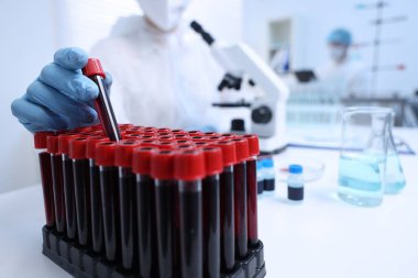 Laboratuvarda test tüplerinde numunelerle çalışan bilim adamı, yakın plan.