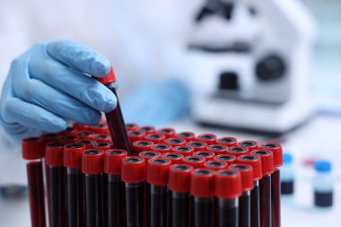 Laboratuvarda test tüplerinde numunelerle çalışan bilim adamı, yakın plan.