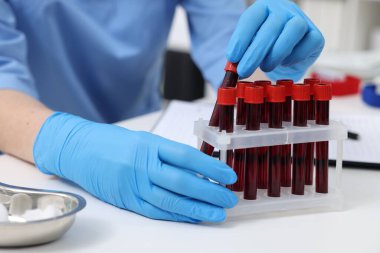 Laboratuvar testi. Kapalı alandaki beyaz masada tüplerde kan örnekleri olan bir doktor.