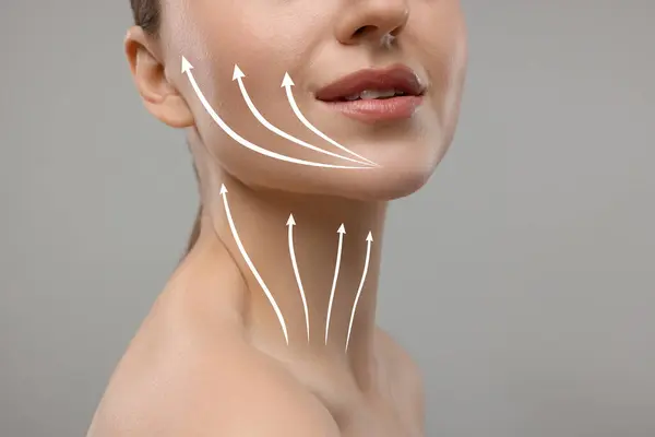 Stock image Woman with perfect skin after cosmetic treatment on grey background, closeup. Lifting arrows on her neck and face