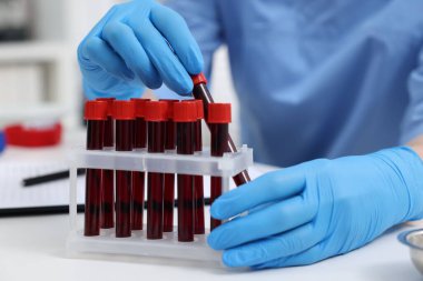 Laboratuvar testi. Kapalı alandaki beyaz masada tüplerde kan örnekleri olan bir doktor.