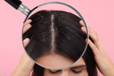 Pembe arka planda kepekten muzdarip bir kadın, yakın plan. Saçını büyüteçle büyüteçle incele.