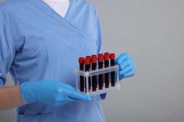 Laboratuvar testi. Açık gri arka planda tüplerde kan örnekleri olan doktor, yakın plan. Metin için boşluk