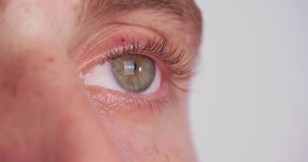 Mladý Muž Smíšenýma Barevnýma Očima Světlém Pozadí Detailní Pohled Zaměření — Stock video