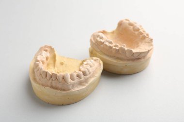 Açık gri arka planda diş etleri olan bir dişçi modeli. Diş kalıpları