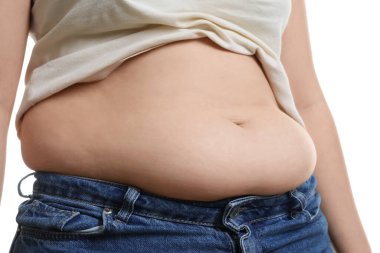 Beyaz arka planda aşırı göbek yağlı bir kadın, yakın plan. Aşırı kilolu