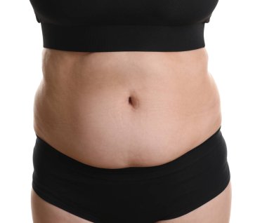 Beyaz arka planda aşırı göbek yağlı bir kadın, yakın plan. Aşırı kilolu