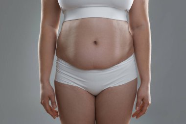 Gri arka planda aşırı göbek yağlı kadın, yakın plan. Aşırı kilolu